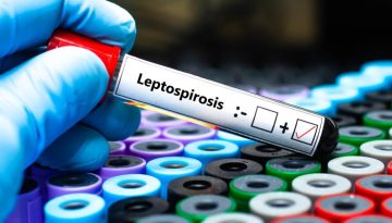 &Lambda;&epsilon;&pi;&tau;&omicron;&sigma;&pi;&epsilon;ί&rho;&omega;&sigma;&eta;: Ύ&pi;&omicron;&pi;&tau;&omicron; &kappa;&rho;&omicron;ύ&sigma;&mu;&alpha; &sigma;&tau;&eta; &Zeta;ά&kappa;&upsilon;&nu;&theta;&omicron; &ndash; 56&chi;&rho;&omicron;&nu;&omicron;&sigmaf; &nu;&omicron;&sigma;&eta;&lambda;&epsilon;ύ&epsilon;&tau;&alpha;&iota; &sigma;&tau;&eta; &Mu;&Epsilon;&Theta; &mu;&epsilon; &sigma;&upsilon;&mu;&pi;&tau;ώ&mu;&alpha;&tau;&alpha; &tau;&eta;&sigmaf; &nu;ό&sigma;&omicron;&upsilon;