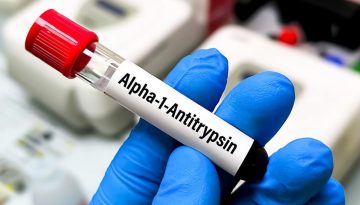 Έ&lambda;&lambda;&epsilon;&iota;&psi;&eta; ά&lambda;&phi;&alpha;-1-&alpha;&nu;&tau;&iota;&theta;&rho;&upsilon;&psi;ί&nu;&eta;&sigmaf;: &Epsilon;&rho;&epsilon;&upsilon;&nu;&eta;&tau;έ&sigmaf;  &epsilon;&pi;&alpha;&nu;&epsilon;&xi;&epsilon;&tau;ά&zeta;&omicron;&upsilon;&nu; &tau;&eta;&nu; &alpha;&sigma;&theta;έ&nu;&epsilon;&iota;&alpha;