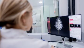 &Kappa;&alpha;&rho;&kappa;ί&nu;&omicron;&sigmaf; &tau;&omicron;&upsilon; &mu;&alpha;&sigma;&tau;&omicron;ύ: &Eta; &tau;&epsilon;&chi;&nu;&eta;&tau;ή &nu;&omicron;&eta;&mu;&omicron;&sigma;ύ&nu;&eta; &mu;&pi;&omicron;&rho;&epsilon;ί &nu;&alpha; &tau;&omicron;&nu; &epsilon;&nu;&tau;&omicron;&pi;ί&zeta;&epsilon;&iota; &pi;&omicron;&lambda;&lambda;ά &chi;&rho;ό&nu;&iota;&alpha; &pi;&rho;&iota;&nu; &epsilon;&kappa;&delta;&eta;&lambda;&omega;&theta;&epsilon;ί