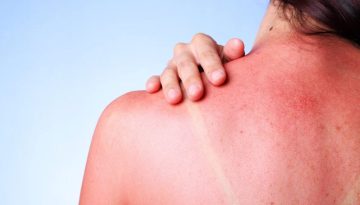 &Pi;ώ&sigmaf; &epsilon;&pi;&eta;&rho;&epsilon;ά&zeta;&epsilon;&iota; &tau;&omicron; &sigma;ώ&mu;&alpha; &eta; &pi;&alpha;&rho;&alpha;&tau;&epsilon;&tau;&alpha;&mu;έ&nu;&eta; έ&kappa;&theta;&epsilon;&sigma;&eta; &sigma;&tau;&omicron;&nu; ή&lambda;&iota;&omicron; &ndash; ygeiatora.gr