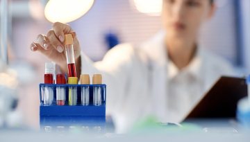 &Kappa;&alpha;&rho;&kappa;ί&nu;&omicron;&sigmaf; &pi;&alpha;&gamma;&kappa;&rho;έ&alpha;&tau;&omicron;&sigmaf;: &Epsilon;&lambda;&pi;ί&delta;&epsilon;&sigmaf; &gamma;&iota;&alpha; έ&gamma;&kappa;&alpha;&iota;&rho;&eta; &alpha;&nu;ί&chi;&nu;&epsilon;&upsilon;&sigma;&eta; &delta;ί&nu;&epsilon;&iota; &epsilon;&xi;έ&tau;&alpha;&sigma;&eta; &alpha;ί&mu;&alpha;&tau;&omicron;&sigmaf; | Vita.gr