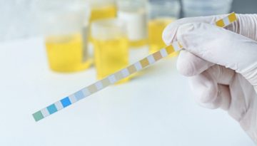 &Mu;&pi;&omicron;&rho;&epsilon;ί &kappa;ά&pi;&omicron;&iota;&omicron;&sigmaf; &nu;&alpha; &pi;ά&theta;&epsilon;&iota; &omicron;&upsilon;&rho;&omicron;&lambda;&omicron;ί&mu;&omega;&xi;&eta; &alpha;&pi;ό &tau;&omicron;&upsilon;&alpha;&lambda;έ&tau;&alpha;; &Tau;&iota; &iota;&sigma;&chi;ύ&epsilon;&iota; &pi;&rho;&alpha;&gamma;&mu;&alpha;&tau;&iota;&kappa;ά &ndash; Healthweb.gr